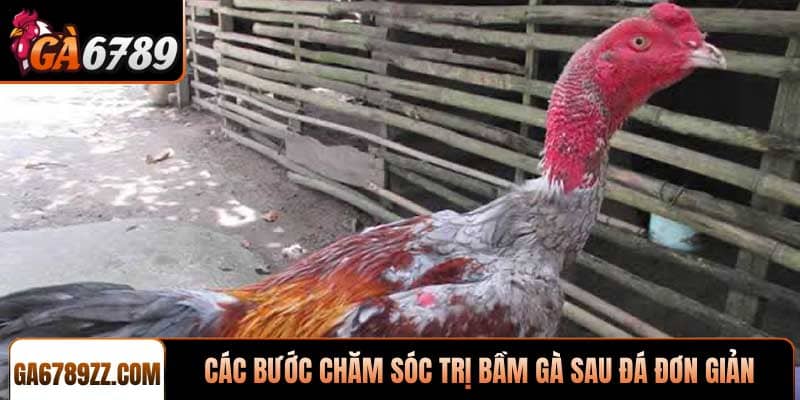 Các bước chăm sóc trị bầm gà sau đá đơn giản